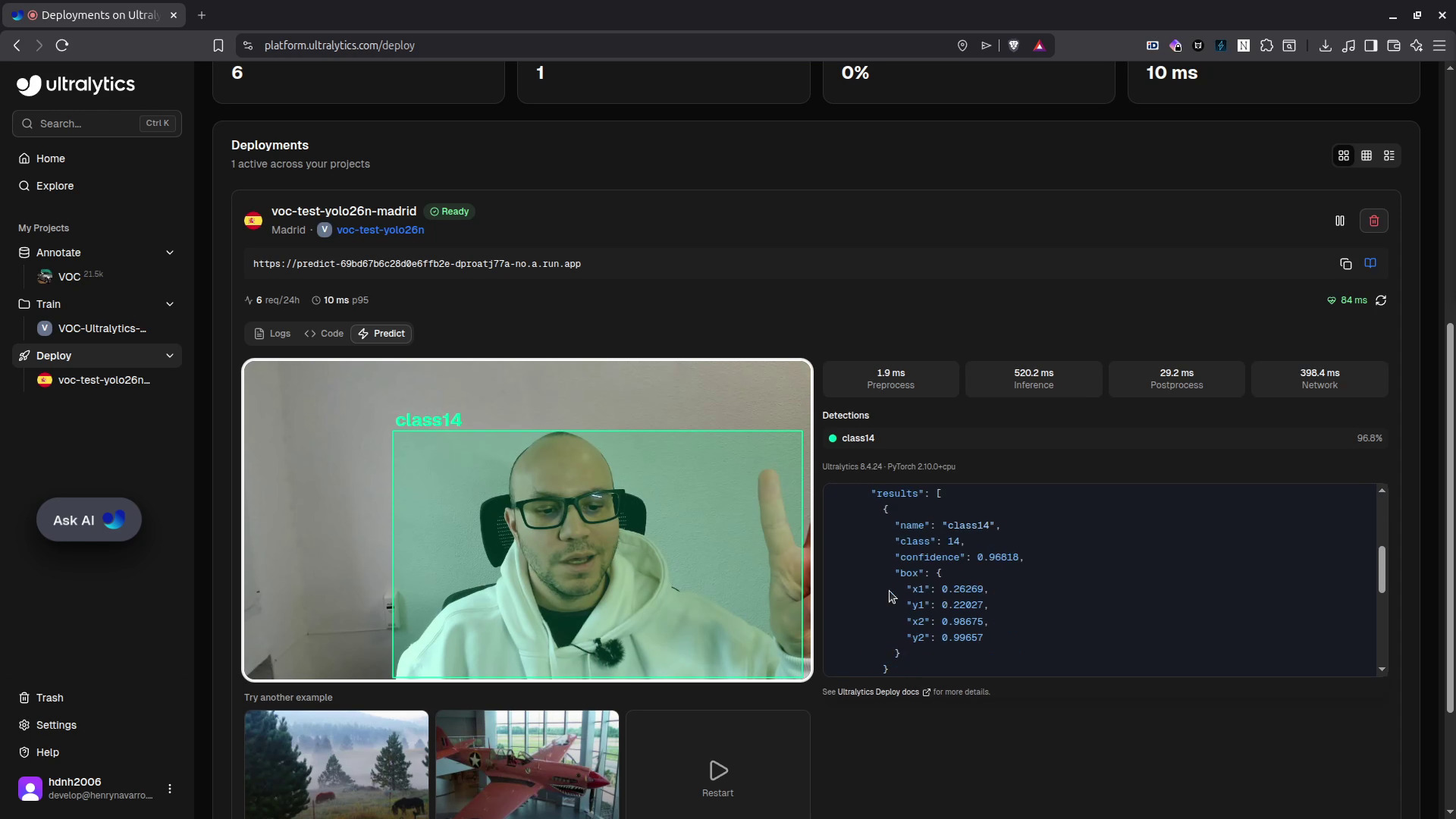YOLO 26 Nano deployed on Ultralytics Platform with API endpoint